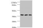 All lanes:Putative tRNAcytidine(32)/guanosine(34)-2-O)-methyltransferase antibody at 2ug/ml<br />
Lane 1 : HepG2 whole cell lysate<br />
Lane 2 : mouse brain tissue<br />
Lane 3 : EC109 whole cell lysate<br />
Secondary<br />
Goat polyclonal to Rabbit IgG