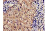 Immunohistochemistry of paraffin-embedded human liver tissue using CSB-PA009062LA01HU at dilution of 1:100