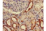 Immunohistochemistry of paraffin-embedded human kidney tissue using CSB-PA009068LA01HU at dilution of 1:100