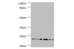 Western blot<br />
All lanes:FXN antibody at 2ug/ml<br />
Lane 1:HepG2 whole cell lysate<br />
Lane 2:Hela whole cell lysate<br />
Lane 3:mouse brain tissue<br />
Lane4:Jurkat whole cell lysate<br />
Secondary<br />
Goat polyclonal to rabbit at 1/10000 di