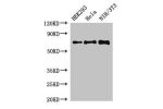Western Blot<br />
Positive WB detected in:HEK293 whole cell lysate,Hela whole cell lysate,NIH/3T3 whole cell lysate<br />
All lanes:FXR1 antibody at 3