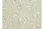 Immunohistochemistry of paraffin-embedded human brain tissue using CSB-PA009090ESR1HU at dilution 1:100