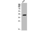 Western Blot analysis of A549 cells using Annexin I Polyclonal Antibody