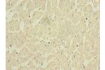 Immunohistochemistry of paraffin-embedded human heart tissue using CSB-PA009097LA01HU at dilution of 1:100