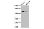 Western Blot<br />
Positive WB detected in:Mouse liver tissue,Mouse kidney tissue<br />
All lanes: FZD9 antibody at 2.5ug/ml<br />
Secondary<br />
Goat polyclonal to rabbit IgG at 1/50000 dilution<br />
Predicted band size: 65 kDa<br />
Observed band size