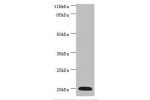 Western blot<br />
All lanes:G0S2 antibody at 2ug/ml+mouse heart tissue<br />
Secondary<br />
Goat polyclonal to rabbit at 1/10000 dilution<br />
Predicted band size: 11kDa<br />
Observed band size: 20kDa<br />