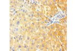 Immunohistochemistry of paraffin-embedded human liver tissue using CSB-PA009118LA01HU at dilution of 1:100