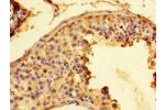 Immunohistochemistry of paraffin-embedded human testis tissue using CSB-PA009121LA01HU at dilution of 1:100