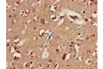 Immunohistochemistry of paraffin-embedded human brain tissue using CSB-PA009141LA01HU at dilution of 1:100