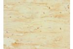 Immunohistochemistry of paraffin-embedded human skeletal muscle tissue CSB-PA009143ESR1HU at dilution 1:100