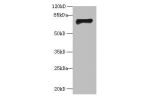Western blot<br />
All lanes:GABRA4 Antibody at 2ug/ml+mouse kidney tissue<br />
Secondary<br />
Goat polyclonal to rabbit at 1/10000 dilution<br />
Predicted band size: 62kDa<br />
Observed band size: 62kDa<br />