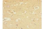 Immunohistochemistry of paraffin-embedded human brain tissue CSB-PA009144ESR1HU at dilution 1:100