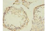 Immunohistochemistry of paraffin-embedded human testis using CSB-PA009147LA01HU at dilution of 1:100