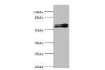 Western blot<br />
All lanes:GABRR1 antibody at 1.25ug/ml+mouse eye tissue<br />
Secondary<br />
Goat polyclonal to rabbit at 1/10000 dilution<br />
Predicted band size: 56,54,46 kDa<br />
Observed band size: 56 kDa<br />
