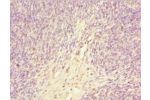 Immunohistochemistry of paraffin-embedded human thymus using CSB-PA009156ESR2HU at dilution 1:100