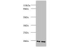 Western blot<br />
All lanes: ADP-ribosylation factor 4 antibody at 2ug/ml<br />
Lane 1 : EC109 whole cell lysate<br />
Lane 2 : 293T whole cell lysate<br />
Secondary<br />
Goat polyclonal to Rabbit IgG at 1/15000 dilution<br />
Predicted band size: 20 k