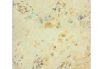 Immunohistochemistry of paraffin-embedded human placenta tissue using CSB-PA009163LA01HU at dilution 1:100