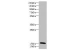 Western blot<br />
All lanes: GADD45G antibody IgG at 5.39ug/ml+ Rat heart tissue<br />
Secondary<br />
Goat polyclonal to rabbit IgG at 1/10000 dilution<br />
Predicted band size: 17 kDa<br />
Observed band size: 17 kDa<br />