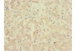 Immunohistochemistry of paraffin-embedded human liver tissue using CSB-PA009164DSR2HU at dilution 1:100
