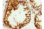 Immunohistochemistry of paraffin-embedded human testis tissue using CSB-PA009190LA01HU at dilution of 1:100
