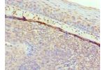 Immunohistochemistry of paraffin-embedded human tonsil using CSB-PA009191ESR1HU at dilution 1:100