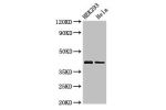 Western Blot<br />
Positive WB detected in:HEK293 whole cell lysate,Hela whole cell lysate<br />
All lanes:GALK1 antibody at 3