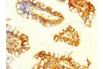 Immunohistochemistry of paraffin-embedded human small intestine tissue using CSB-PA009199LA01HU at dilution of 1:100