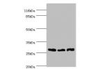 Western blot<br />
All lanes:Guanidinoacetate N-methyltransferase antibody at 2ug/ml<br />
Lane 1:mouse thymus tissue<br />
Lane 2:293T whole cell lysate<br />
Lane 3:Jurkat whole cell lysate<br />
Secondary<br />
Goat polyclonal to rabbit at 1/10000 dilu