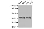 Western Blot<br />
Positive WB detected in Recombinant protein<br />
All lanes:GAPDH antibody at 3