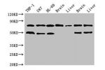 Western Blot<br />
Positive WB detected in:THP-1 whole cell lysate,U87 whole cell lysate,HL-60 whole cell lysate,Mouse brain tissue,Mouse liver tissue,Rat brain tissue,Rat liver tissue<br />
All lanes:GARS antibody at 3