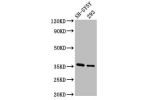 Western Blot<br />
Positive WB detected in:SH-SY5Y whole cell lysate,293 whole cell lysate<br />
All lanes:GAS1 antibody at 3.2
