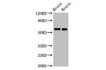 Western Blot<br />
Positive WB detected in:Mouse brain tissue,Rat brain tissue<br />
All lanes:GAS7 antibody at 2.5