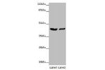 Western blot<br />
All lanes: GATA1 antibody at 7 ug/ml<br />
Lane 1 : MCF7 whole cell lysate<br />
Lane 2 : A549 whole cell lysate<br />
Secondary<br />
Goat polyclonal to rabbit IgG at 1/10000 dilution<br />
Predicted band size: 43,36,35 kDa<br />
Obser