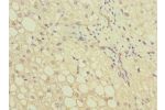 Immunohistochemistry of paraffin-embedded human liver tissue CSB-PA009283ESR1HU at dilution 1:100
