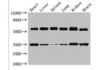 Western Blot<br />
Positive WB detected in:Mouse heart tissue,Mouse liver tissue,Mouse spleen tissue,Mouse lung tissue,Mouse kidney tissue,Mouse brain tissue<br />
All lanes:Gba antibody at 3.5ug/ml<br />
Secondary<br />
Goat polyclonal to rabbit IgG at 1