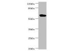 All lanes:Interferon-induced guanylate-binding protein 1 antibody at 4ug/ml<br />
Lane 1:MM231 whole cell lysate<br />
Lane 2:Hela whole cell lysate<br />
Lane 3:MGF-7 whole cell lysate<br />
Secondary<br />
Goat polyclonal to rabbit at 1/10000 dilution<b