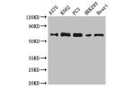 Western Blot<br />
Positive WB detected in:A375 whole cell lysate,K562 whole cell lysate,PC3 whole cell lysate,HEK293 whole cell lysate,Mouse heart tissue<br />
All lanes:GBP2 antibody at 6.2ug/ml<br />
Secondary<br />
Goat polyclonal to rabbit IgG at 1/5