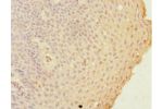 Immunohistochemistry of paraffin-embedded human tonsil tissue using CSB-PA009307DSR1HU at dilution 1:100