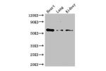 Western Blot<br />
Positive WB detected in:Mouse heart tissue,Mouse lung tissue,Mouse kidney tissue<br />
All lanes: Gcgr antibody at 3ug/ml<br />
Secondary<br />
Goat polyclonal to rabbit IgG at 1/50000 dilution<br />
Predicted band size: 55 kDa<br />
Ob
