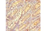 Immunohistochemistry of paraffin-embedded human small intestine tissue using CSB-PA009318LA01HU at dilution of 1:100