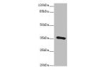 Western blot<br />
All lanes: GDAantibody at 1.24ug/ml+ Hela whole cell lysate<br />
 Goat polyclonal to rabbit at 1/10000 dilution<br />
Predicted band size: 52,43,53 kDa<br />
Observed band size: 36 kDa<br />