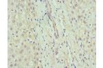 Immunohistochemistry of paraffin-embedded human liver tissue using CSB-PA009337ESR2HU at dilution 1:100