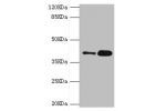 Western blot<br />
All lanes:GDAP1 antibody at 4.15ug/ml<br />
Lane 1:MCF-7 whole cell lysate<br />
Lane 2:mouse brain tissue<br />
Secondary<br />
Goat polyclonal to rabbit at 1/10000 dilution<br />
Predicted band size: 42,34 kDa<br />
Observed band size