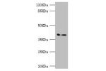 Western blot<br />
All lanes:GDAP1 antibody at 1.11ug/ml+mouse brain tissue<br />
Secondary<br />
Goat polyclonal to rabbit at 1/10000 dilution<br />
Predicted band size: 42,34 kDa<br />
Observed band size: 41 kDa<br />