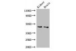 Western Blot<br />
Positive WB detected in:Mouse kidney tissue,Mouse brain tissue<br />
All lanes:GDF11 antibody at 3
