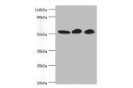 Western blot<br />
All lanes:GDI2 antibody at 2ug/ml<br />
Lane 1:mouse brain tissue<br />
Lane 2:HepG2 whole cell lysate<br />
Lane 3:MCF-7 whole cell lysate<br />
Secondary<br />
Goat polyclonal to rabbit at 1/10000 dilution<br />
Predicted band size: 5