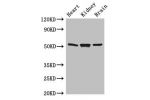 Western Blot<br />
Positive WB detected in:Mouse heart tissue,Mouse kidney tissue,Mouse brain tissue<br />
All lanes: Gfap antibody at 3ug/ml<br />
Secondary<br />
Goat polyclonal to rabbit IgG at 1/50000 dilution<br />
Predicted band size: 50,51 kDa<br /