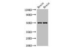 Western Blot<br />
Positive WB detected in:Mouse brain tissue,Rat brain tissue<br />
All lanes:Gfap antibody at 2.7