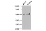 Western Blot<br />
Positive WB detected in:MCF-7 whole cell lysate,Mouse kidney tissue<br />
All lanes:GFRA1 antibody at 3ug/ml<br />
Secondary<br />
Goat polyclonal to rabbit IgG at 1/50000 dilution<br />
Predicted band size: 52,51 kDa<br />
Observed ban