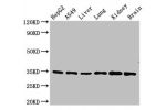 Western Blot<br />
Positive WB detected in:HepG2 whole cell lysate,A549 whole cell lysate,Mouse liver tissue,Mouse lung tissue,Mouse kidney tissue,Mouse brain tissue<br />
All lanes:GFRA2 antibody at 3.5ug/ml<br />
Secondary<br />
Goat polyclonal to rabbi